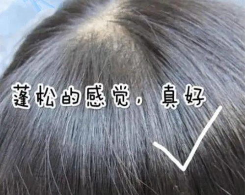 如何掌握洗头的最佳频率?揭秘男生头发清洁的黄金定律