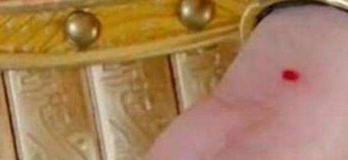 古代女子婚前体检：揭秘传统婚俗中的健康关卡